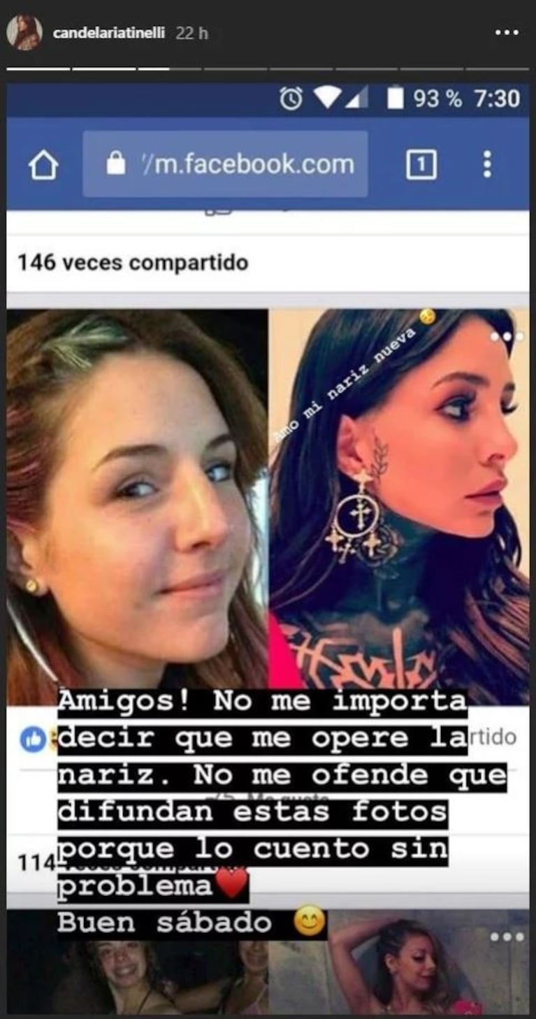Cande Tinelli habló de la cirugía estética en su cara: "No me importa decir que me operé la nariz"