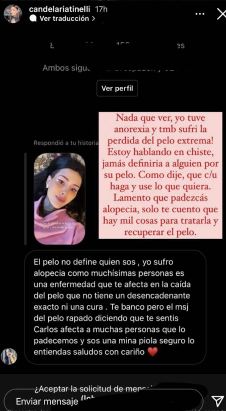 Cande Tinelli hizo referencia a corazón abierto a los trastornos alimenticios que padeció: "Sufría pérdida de cabello extrema"