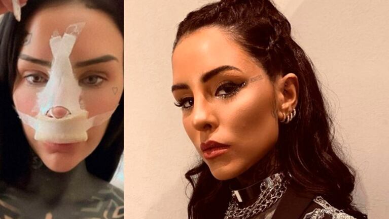 Cande Tinelli salió con todo al cruce de las críticas por sus cirugías.
