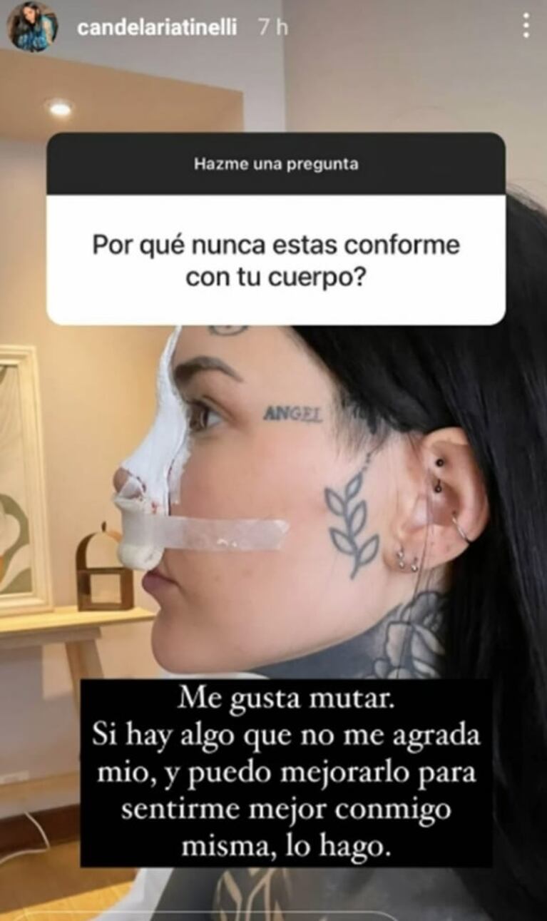 Cande Tinelli salió con todo al cruce de las críticas por sus cirugías: "La vida es corta"