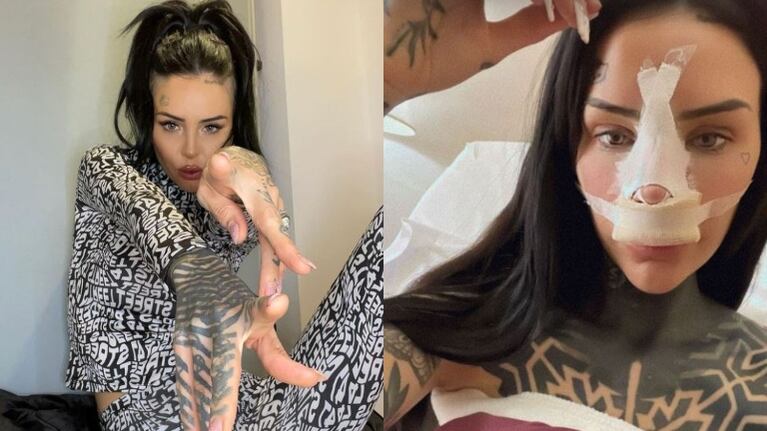 Cande Tinelli se sometió a una cirugía estética y compartió una foto en sus redes sociales (Fotos: Instagram y Captura de Instagram Stories)