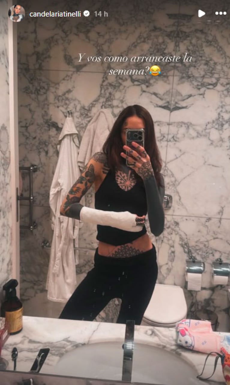 Cande Tinelli sufrió un accidente y será operada (Foto: Instagram)