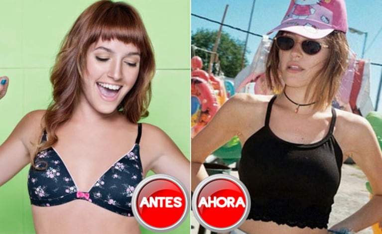 Candela Vetrano, sobre su operación de lolas: "Tomé la decisión de un día para el otro" (Foto: Web)