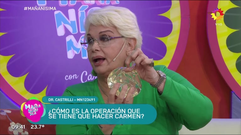 Carmen Barbieri contó cómo será la cirugía estética a la que se someterá: “No estaba en mis planes”