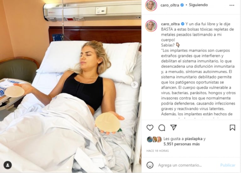 Carolina Oltra pasó por el quirófano y contó su decisión de quitarse los implantes de lolas: "Lastimaban mi cuerpo"