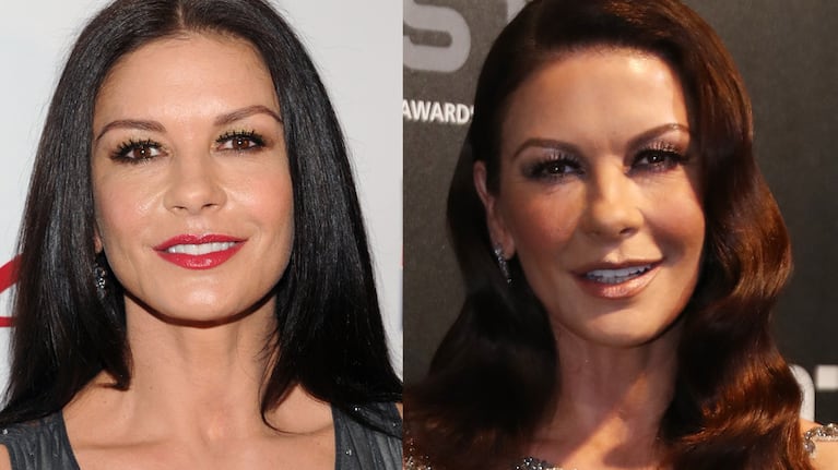 ¿Catherine Zeta-Jones se sometió a alguna cirugía plástica?