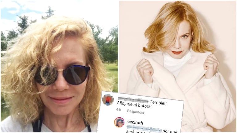 Cecilia Roth, al cruce cuando le dijeron que tenía que aflojale al botox: No uso, hay buenas cremas
