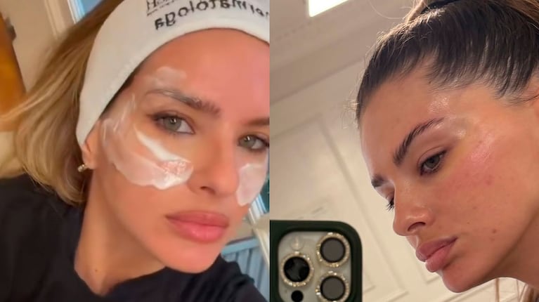 China Suárez mostró el tratamiento facial para reafirmar la piel: qué es Ultherapy y cómo funciona (captura de redes sociales)