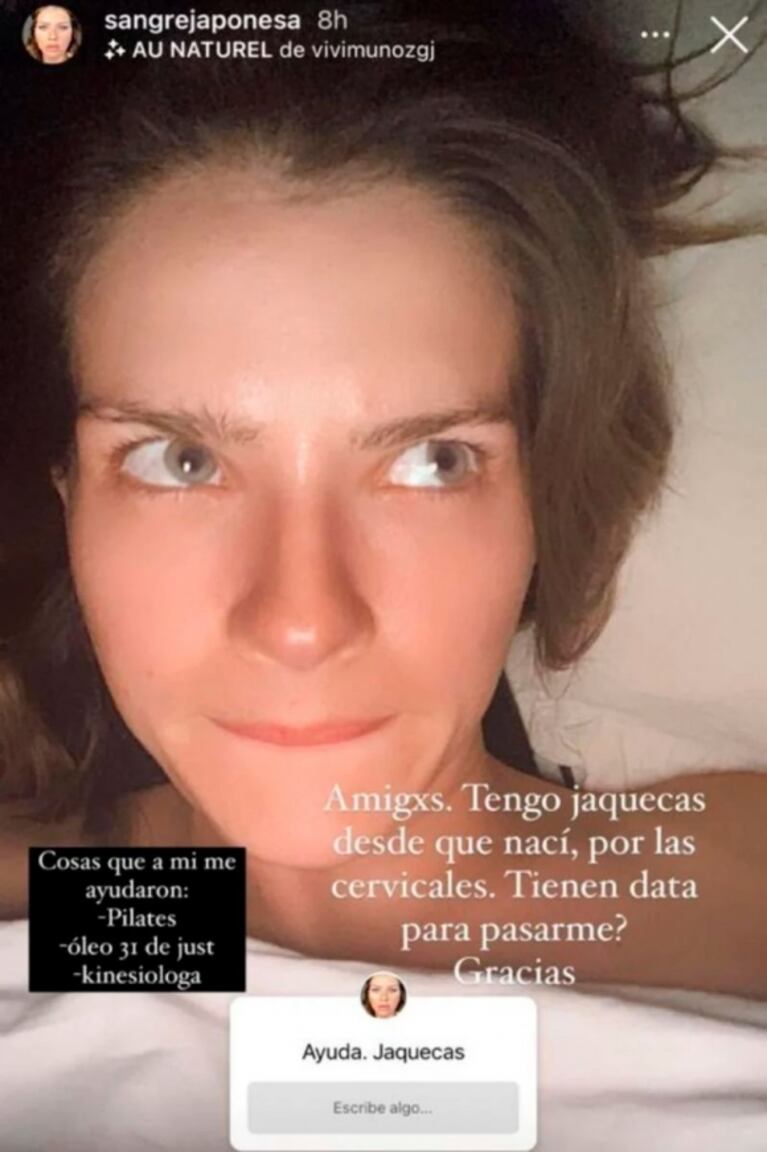 China Suárez reveló que padece una afección desde que nació y pidió consejos: "Tengo jaquecas por las cervicales"
