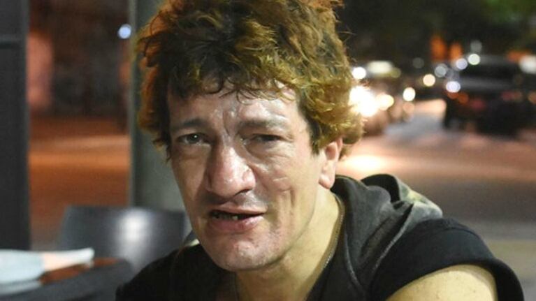 Chocó Pity Álvarez con su moto: fue trasladado en helicóptero y está internado.