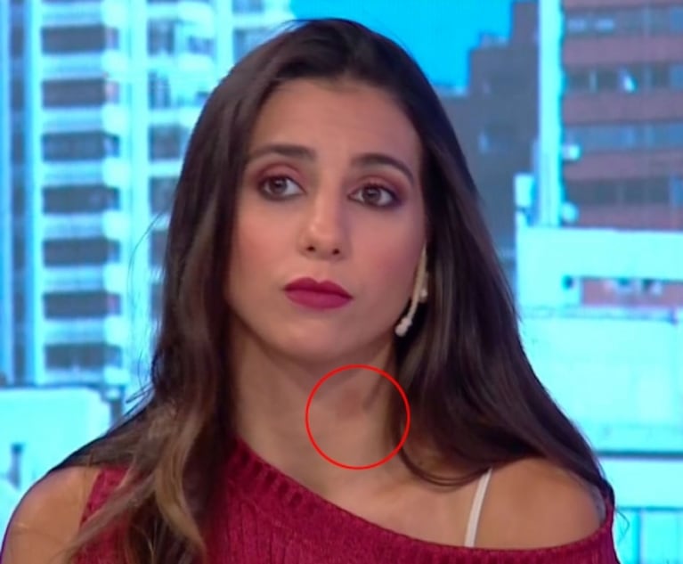 Cinthia Fernández explicó su marca en el cuello: "Me la di con una pesa, sino sería un chupón re deforme"