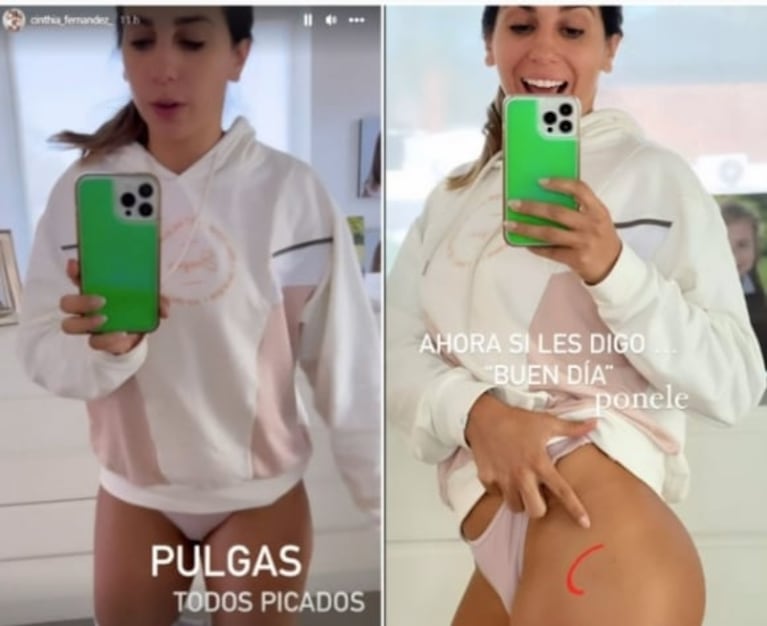 Cinthia Fernández mostró cómo le quedó la cola luego de ser picada por las pulgas: "Llena de picaduras"