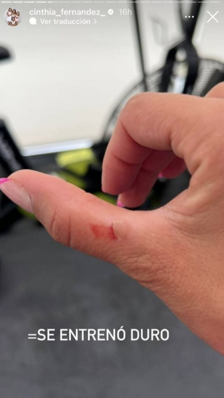 Cinthia Fernández se lastimó en el gimnasio y mostró la herida con una foto: "Se entrenó duro"