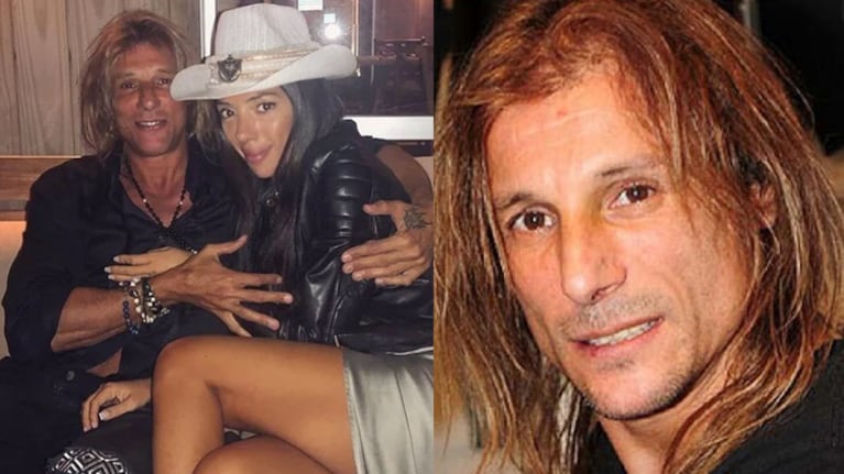 Claudio Caniggia se hizo un tratamiento estético a pedido de su novia.