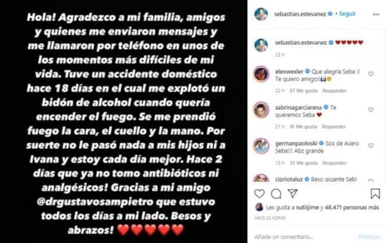 Conmovedor mensaje de Ivana Saccani a Sebastián Estevanez tras quemarse la cara: "Admiro tu fortaleza"