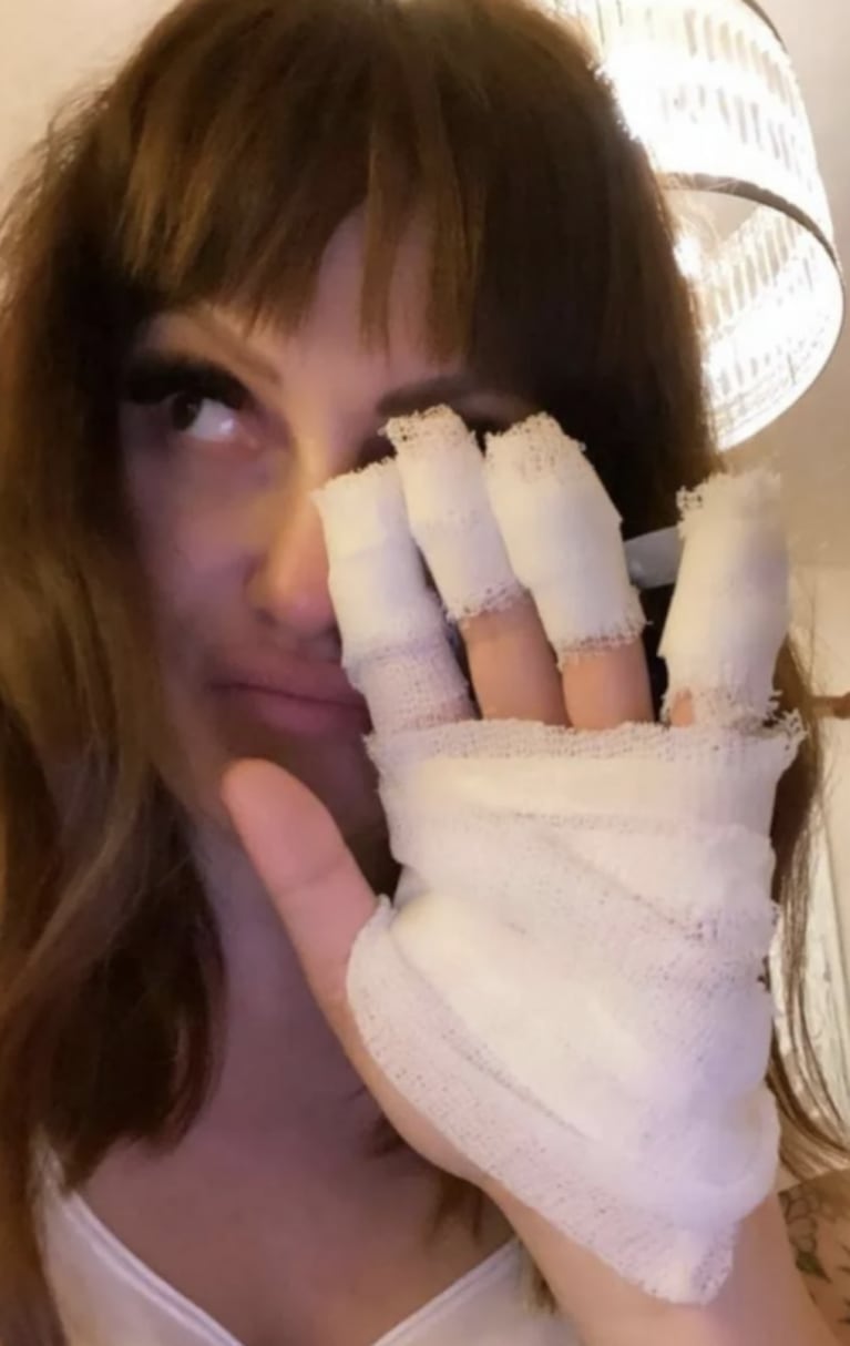 Connie Ansaldi sufrió un accidente doméstico y mostró su mano vendada: "Me quemé con la buclera"