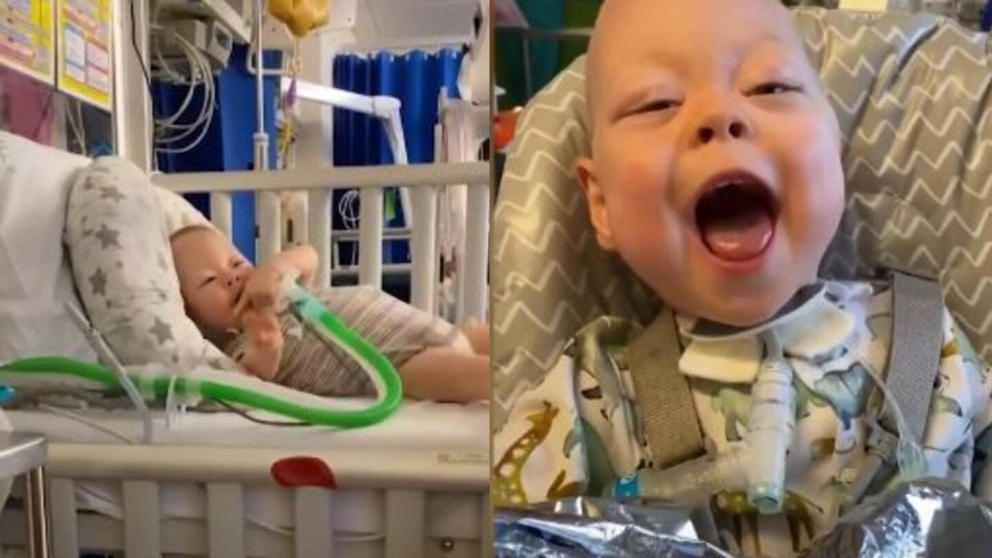 Conoce la historia de Archie, el bebé milagro que volvió a casa después de 600 días en el hospital