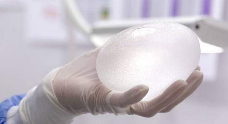 Conocé las ventajas de los implantes ergonómicos