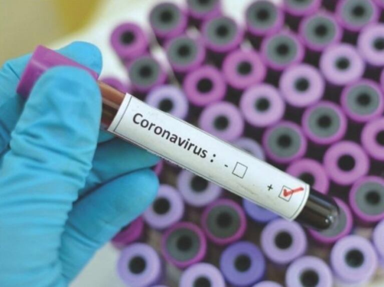 Crece la preocupación: detectan un segundo caso positivo de coronavirus en la Argentina