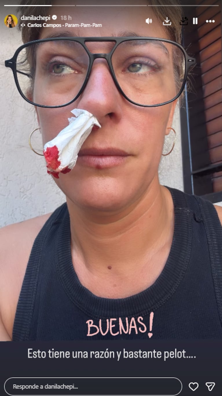 Dani La Chepi se mostró ensangrentada: “Bastante pelotud…” | Créditos: Instagram @danilachepi