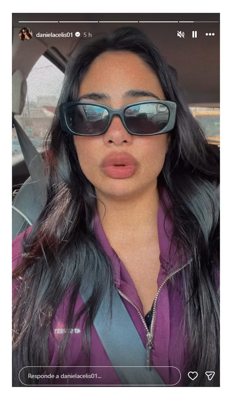 Daniela Celis hizo una reflexión luego de la pinchadura. Captura: Instagram danielacelis01