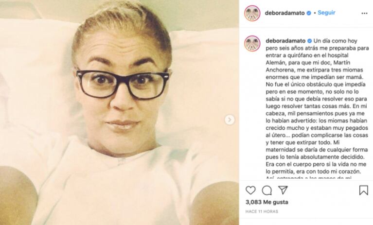 Débora D'Amato y su fuerte relato sobre la cirugía a la que tuvo que someterse para convertirse en mamá: "El doctor dijo que me había salvado el útero"