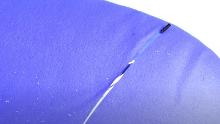 Desarrollan la primera tecnología endovascular que puede explorar capilares