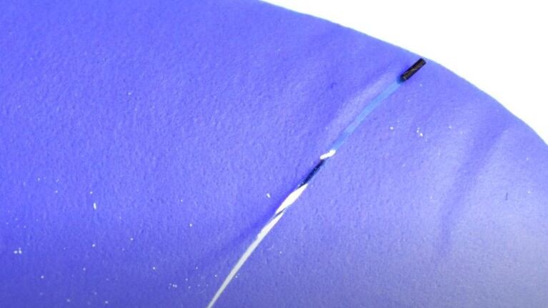 Desarrollan la primera tecnología endovascular que puede explorar capilares
