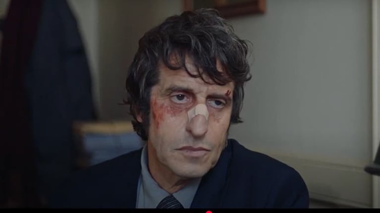 Diego Peretti se convierte en un imitador de Serge Gainsbourg venido a menos.