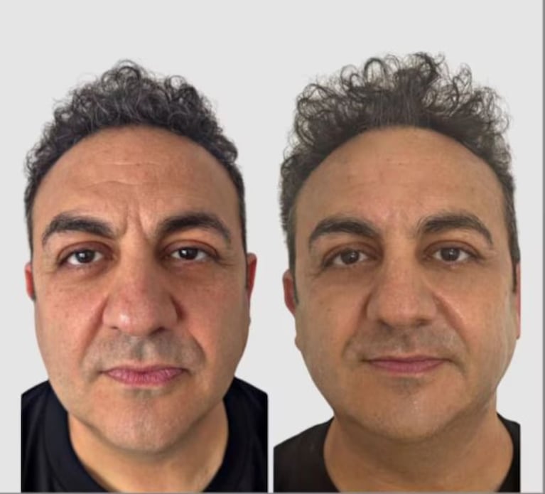 Diego Topa mostró el retoque estético que se hizo y sorprendió con el resultado. Crédito: Instagram