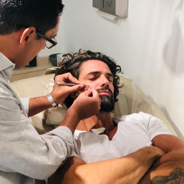 El accidente playero de Luciano Castro, que mostró cómo quedó su cara: "¡Golpazo con la tabla de surf!"