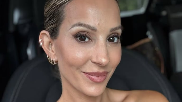 El cambio se nota especialmente en las manchas y ojeras.   Crédito: Instagram @noeliamarzolok