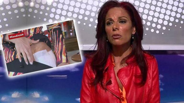 El doloroso accidente de Iliana Calabró. (Foto: Web)