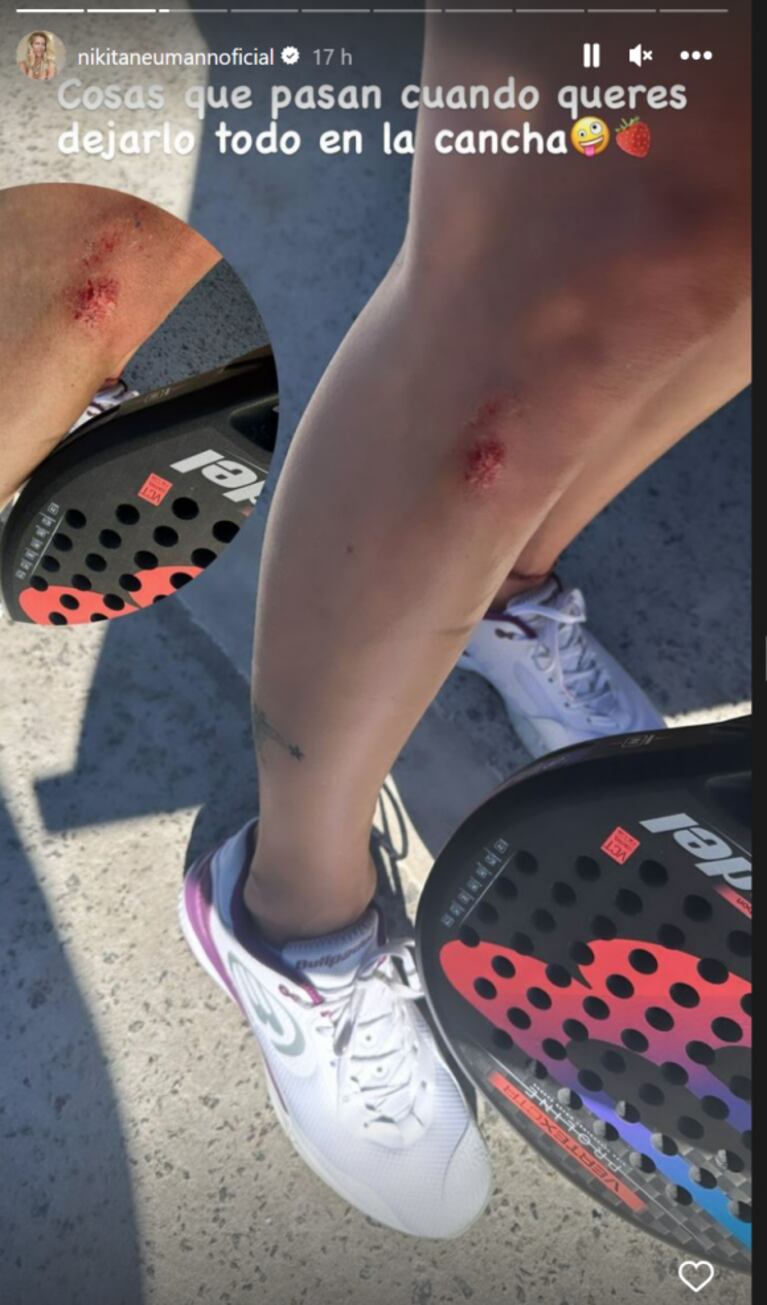 El doloroso accidente de Nicole Neumann jugando al padel: “Dejarlo todo en la cancha”