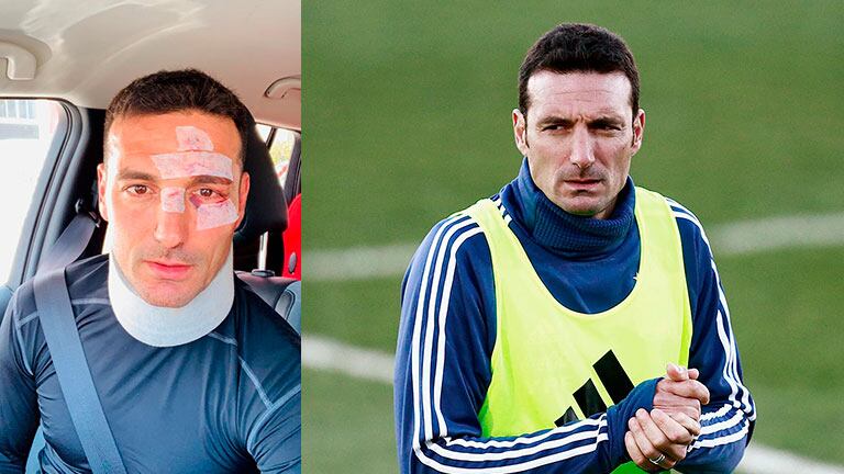 El DT de Argentina, Lionel Scaloni, fue atropellado en España, sufrió lesiones leves y ya fue dado de alta