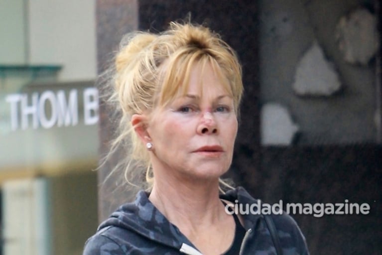 El duro momento de Melanie Griffith: batería de cirugías para verse "más normal" y su lucha contra el cáncer de piel