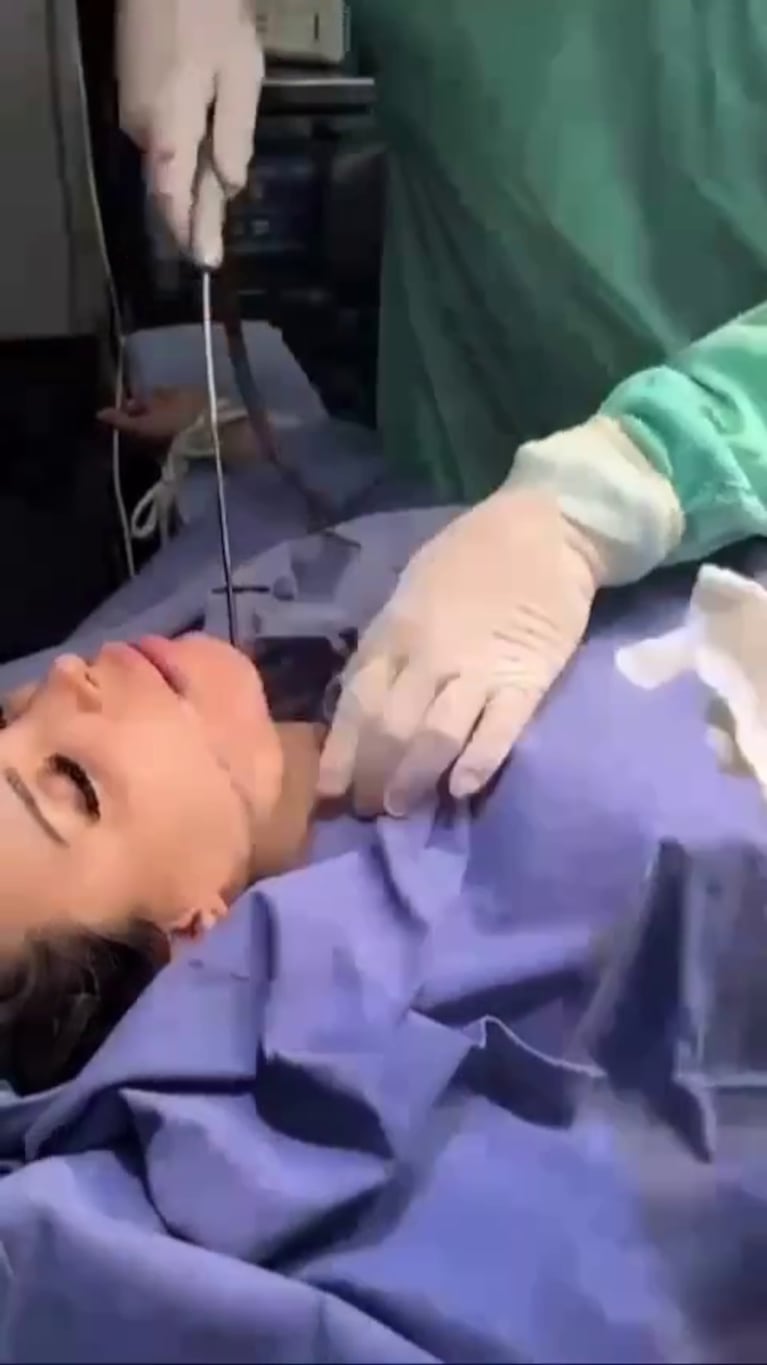 El impactante video de Charlotte Caniggia en el quirófano haciéndose una cirugía estética