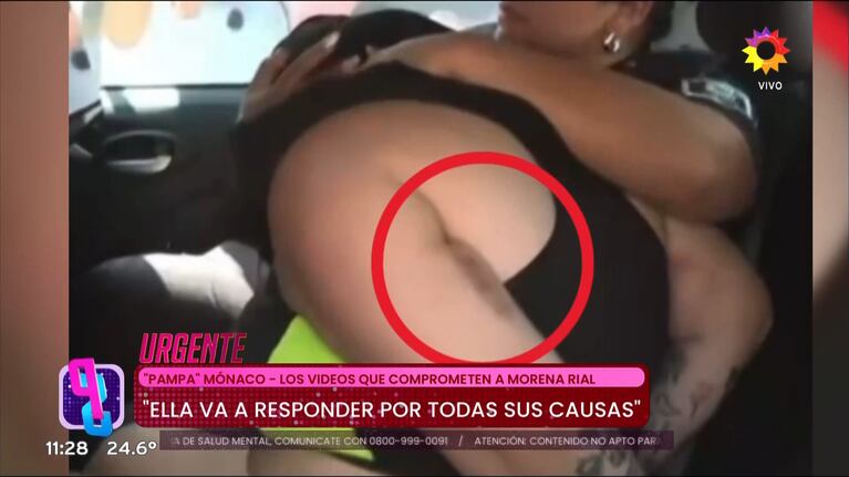 El moretón de Morena Rial en su brazo al ser trasladada de la comisaría a la fiscalía.