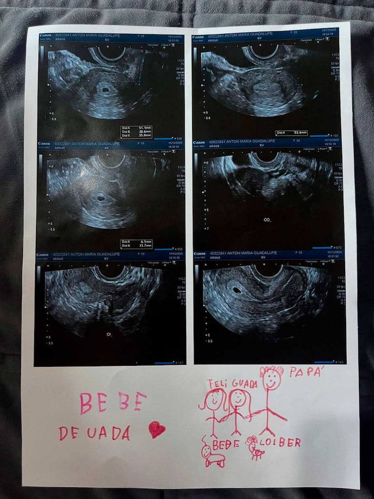 El posteo de Guadalupe Antón anunciando su embarazo (Foto: Instagram @guadalupeantonok)