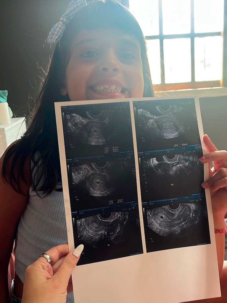 El posteo de Guadalupe Antón anunciando su embarazo (Foto: Instagram @guadalupeantonok)