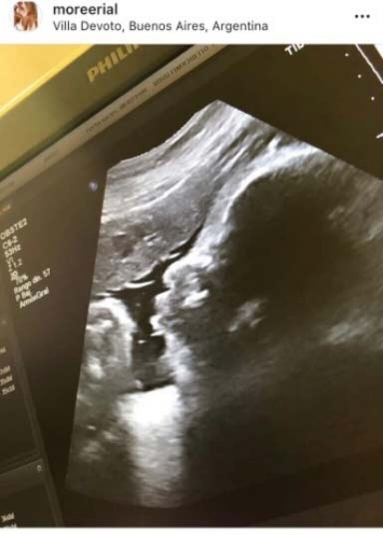 El tierno posteo que Morena Rial le dedicó a su bebé, a dos semanas de dar a luz: "Te estamos esperando"