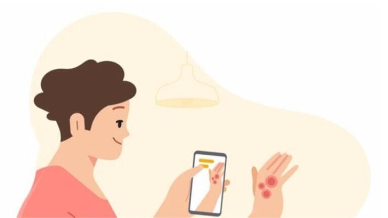El último proyecto de IA de Google: identificar problemas de la piel con la cámara del móvil