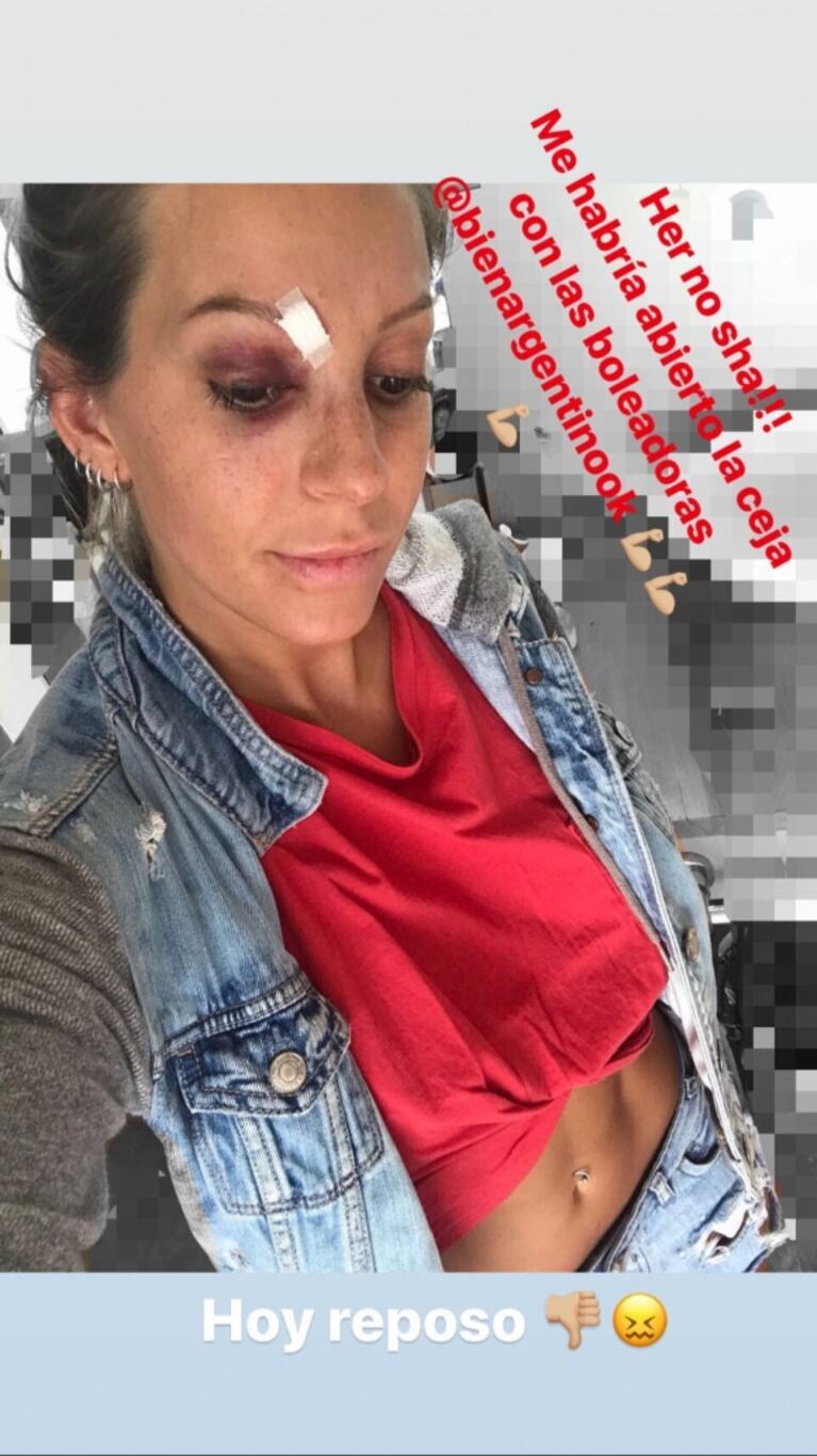 El video del fuerte accidente de Noelia Marzol en Bien Argentino: "Se enredaron las boleadoras, me golpeé, me corté la ceja y sangré mucho, me dieron reposo por unos días"