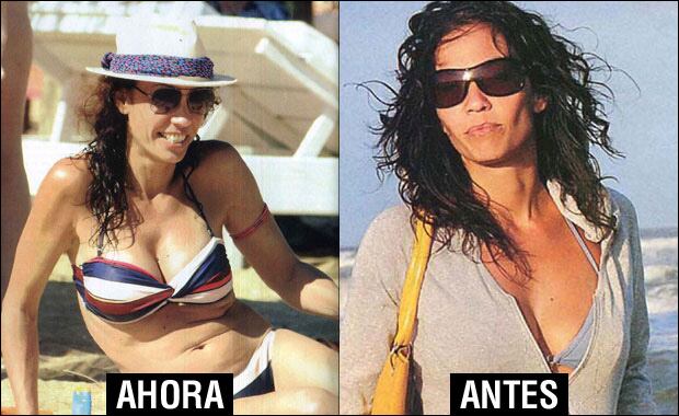 Ernestina Pais ya luce su nuevo escote en la playa. (Foto: revista Pronto)