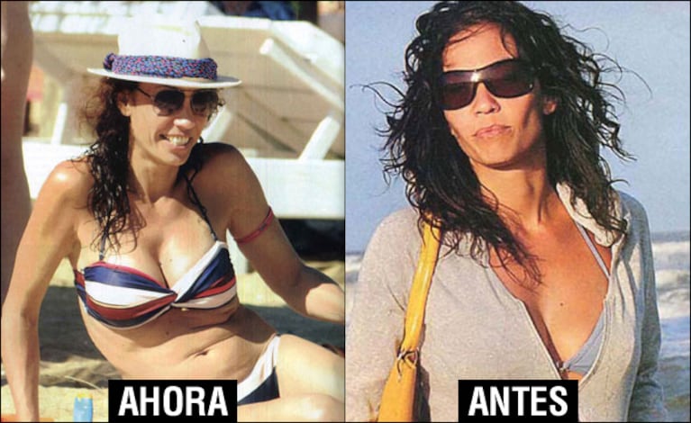 Ernestina Pais ya luce su nuevo escote en la playa. (Foto: revista Pronto)