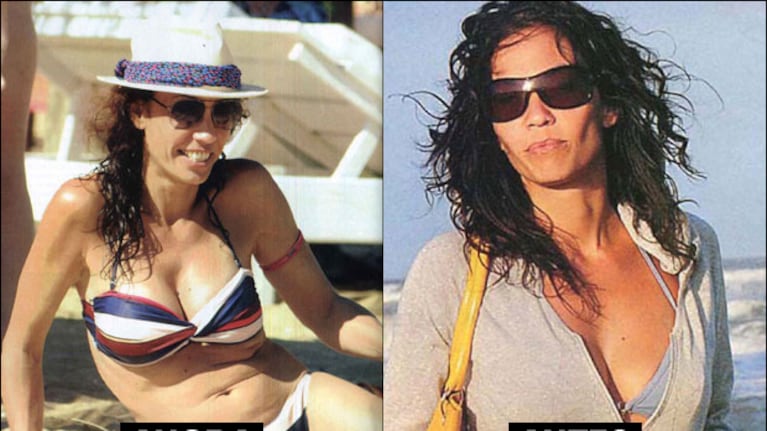 Ernestina Pais ya luce su nuevo escote en la playa. (Foto: revista Pronto)