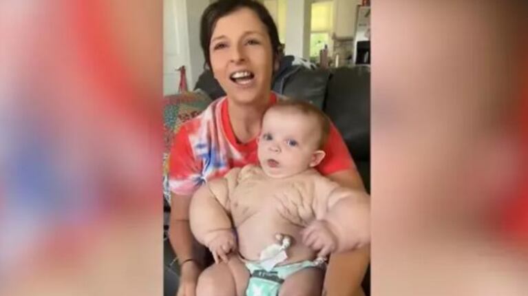 Esta niña apodada “Bebé Hulk” nace con los brazos y el pecho extremadamente grandes