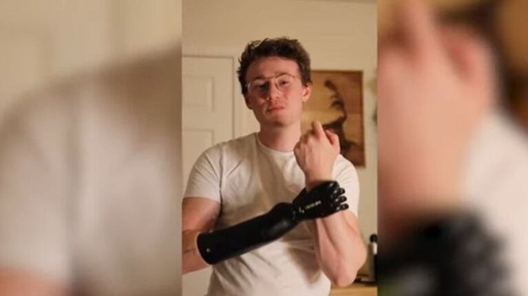 Este joven de 25 años enseña las aventuras y desventuras con su mano biónica 