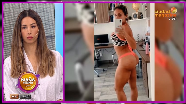 Estefi Berardi opinó del cuerpo de la esposa de Aníbal Lotocki, operada por el cirujano: “Parece cemento”
