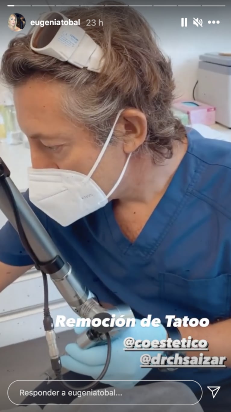 Eugenia Tobal reveló por qué decidió removerse uno de sus tatuajes: "No representa lo que yo quería"
